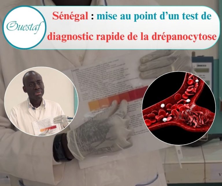 Mise au point d'un test de diagnostic rapide (TDR) de la drépanocytose par une équipe de l'Ucad